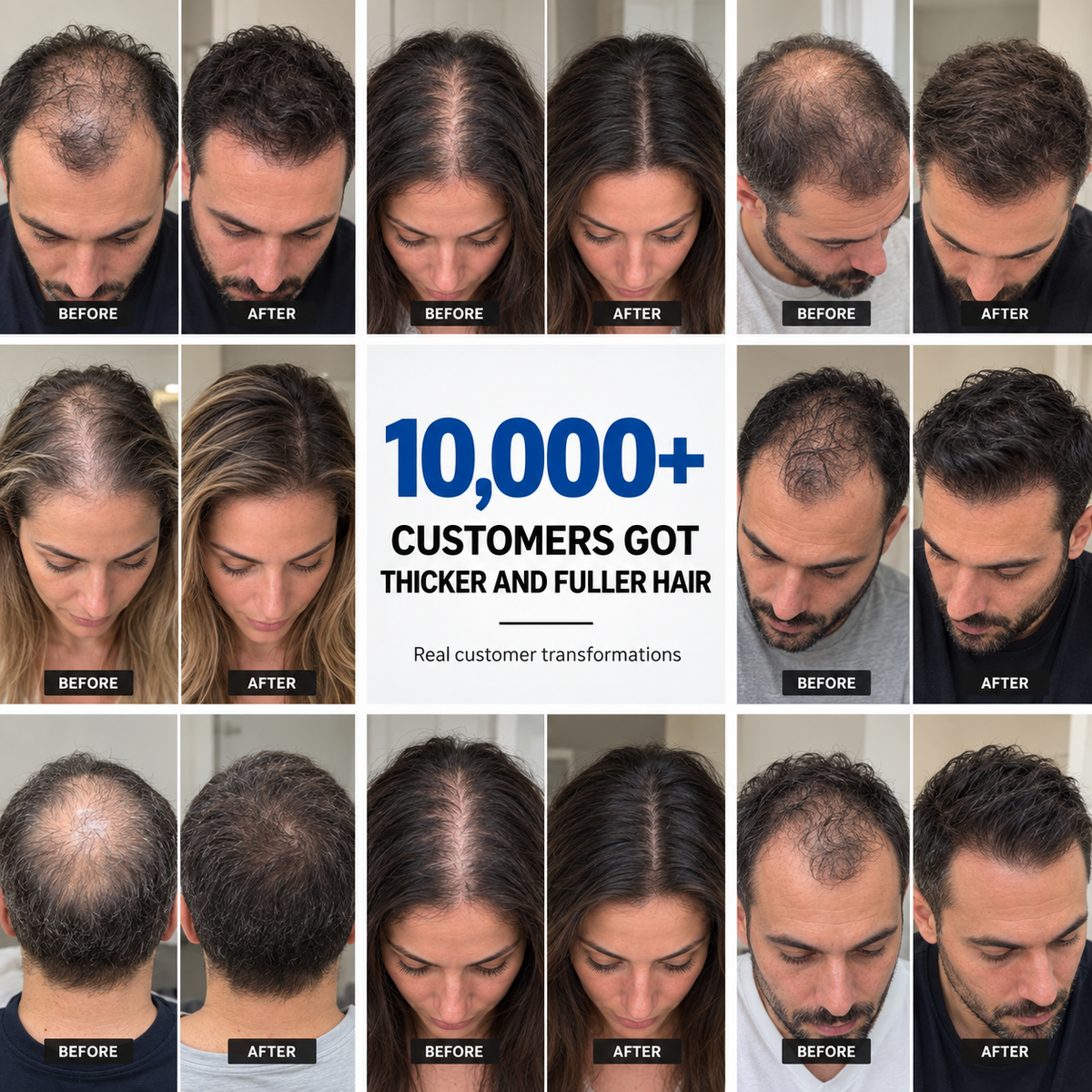 The Most Powerful Peptide Infusion Hair Regrowth System