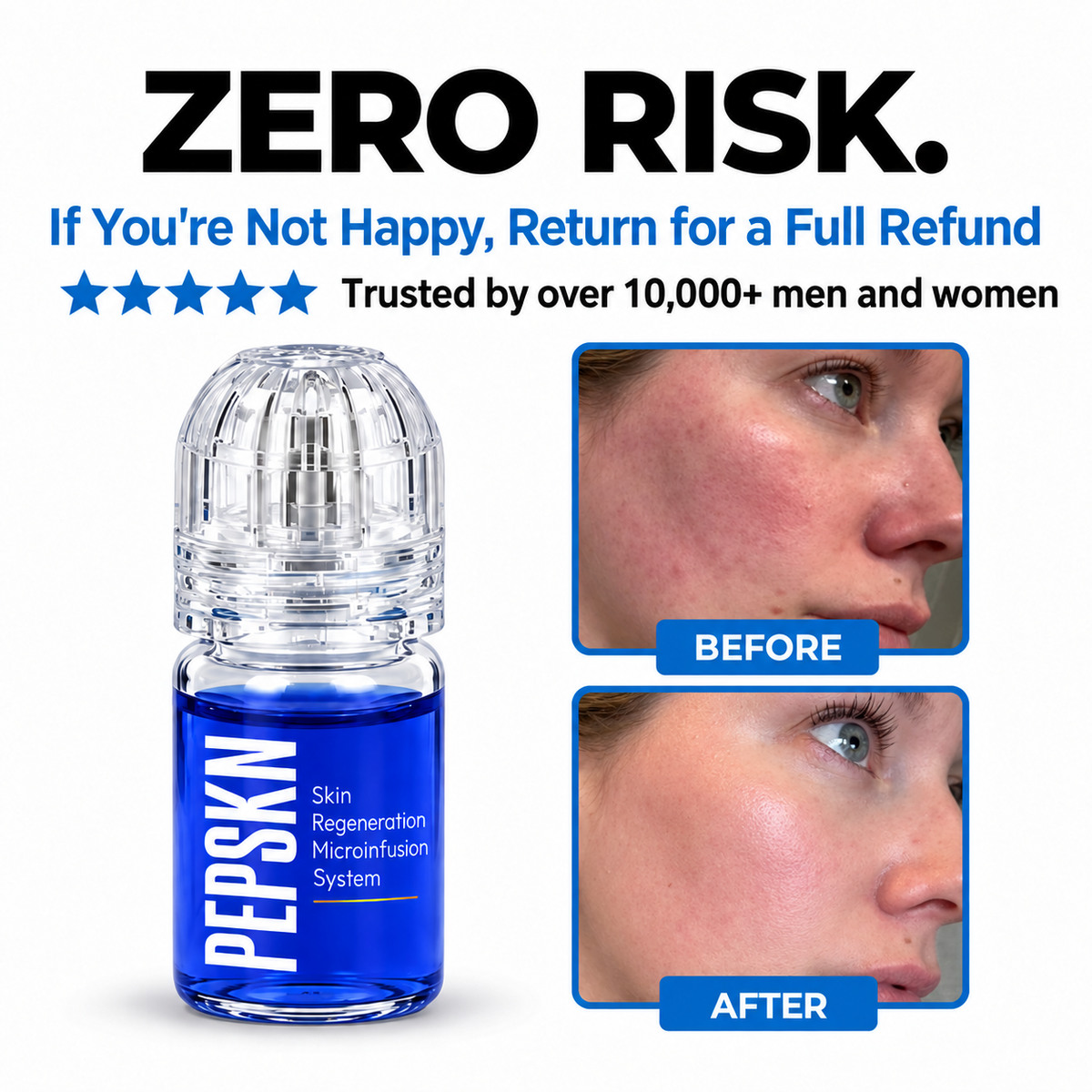 PEPSKN The Most Advanced Copper Peptide Skin Regeneration System