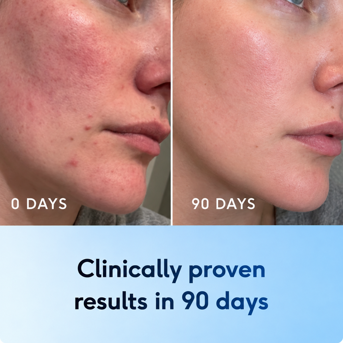 The Most Advanced Youth Copper Peptide Serum Powered by Pure GHK-cu