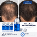 Accelerated Hair Growth Bundle (Micro-infusion + Serum)