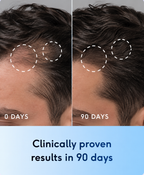 The Most Powerful Hair Regrowth Oil GHK-Cu + AHK-Cu Copper Peptides