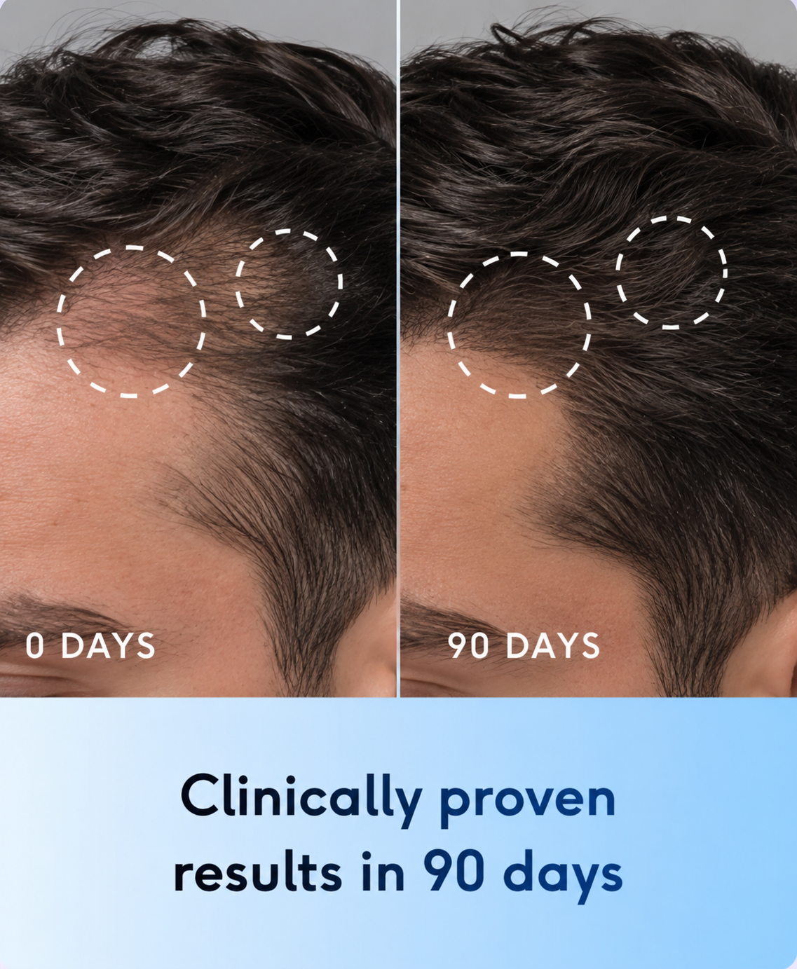 The Most Powerful Hair Regrowth Oil GHK-Cu + AHK-Cu Copper Peptides