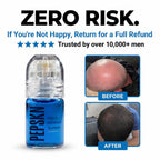 Accelerated Hair Growth Bundle (Micro-infusion + Serum)